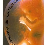 baby in womb - why kill me?